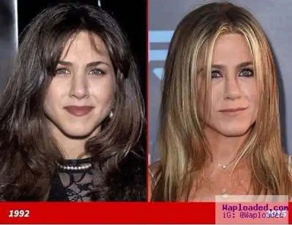 Jennifer Aniston: Good Genes or Good Docs?